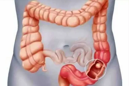 நெஞ்செரிச்சல் பிரச்சனைக்கு தீர்வு தரும் ஜூஸ் வகைகள்