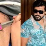 நடிகர் அருண் விஜய் படப்பிடிப்பில் காயமடைந்த நிலையில் சிகிச்சை பெறுவது