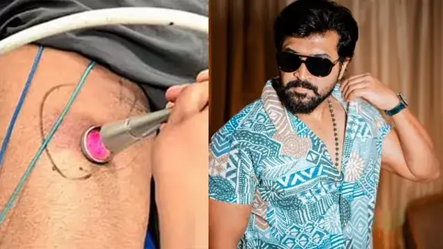 நடிகர் அருண் விஜய் படப்பிடிப்பில் காயமடைந்த நிலையில் சிகிச்சை பெறுவது