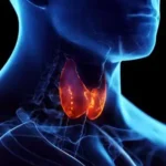 தைராய்டு அறிகுறிகள் குறித்த மருத்துவ விளக்கப்படம்